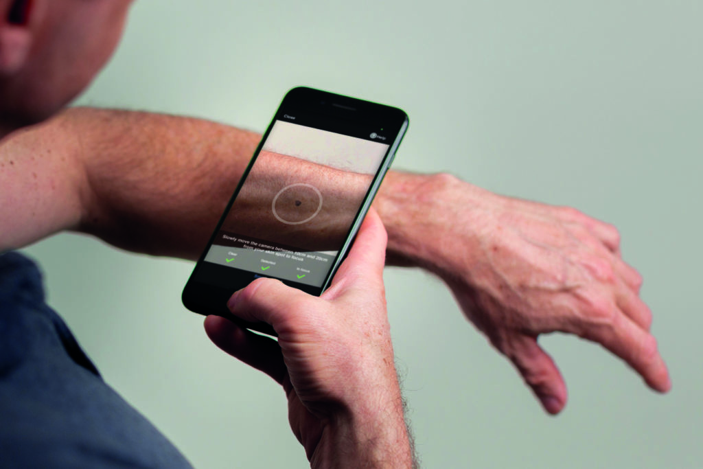 SkinVision-–-Detect-Skin-Cancer-Early-with-AI
